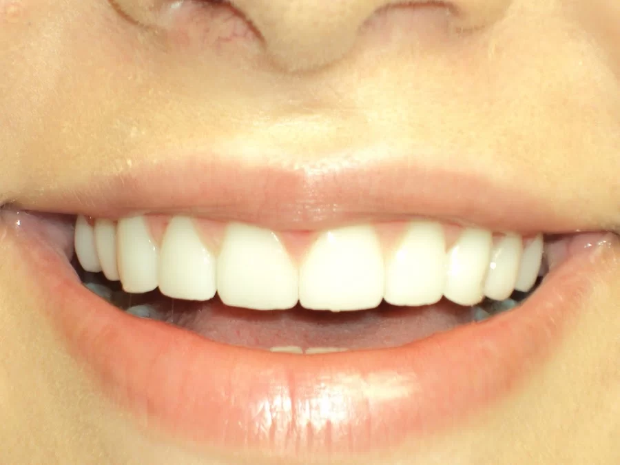 OC Elite Dental - Dentist in Anaheim Picture 1