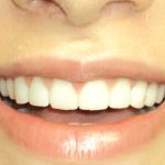 OC Elite Dental - Dentist in Anaheim