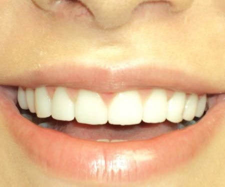 OC Elite Dental - Dentist in Anaheim