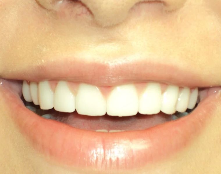 OC Elite Dental - Dentist in Anaheim