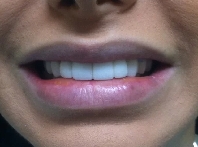 OC Elite Dental - Dentist in Anaheim Picture 4