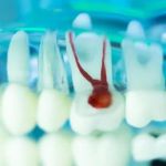 Kiwan Dental Care & Dental Implants Center