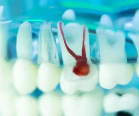 Kiwan Dental Care & Dental Implants Center