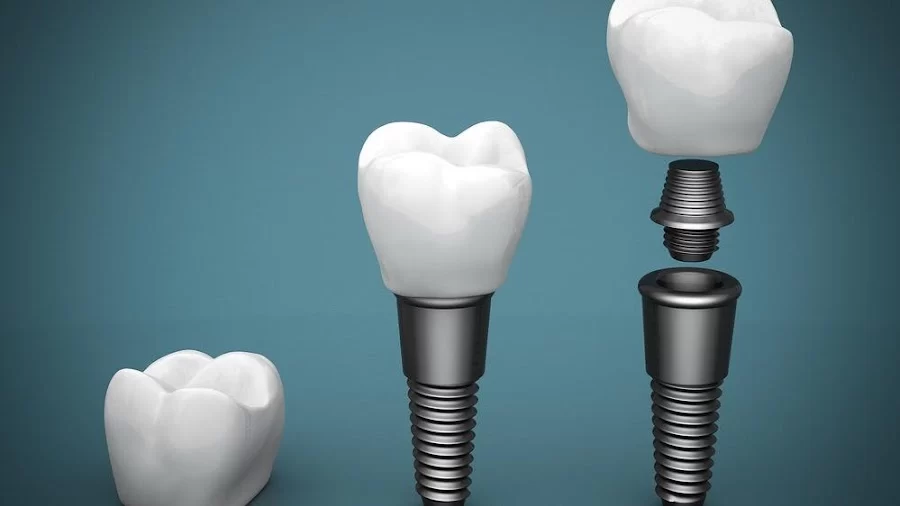 Kiwan Dental Care & Dental Implants Center 6