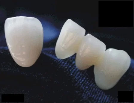 Richard Haber, D.D.S. Santa Monica Dentist Picture 6