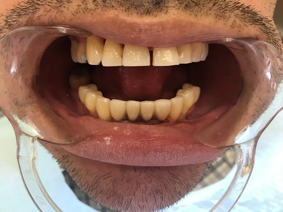 Diamond Dental Specialty Periodontics & Orthodontics Picture 8
