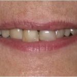Nainesh A Desai, DDS