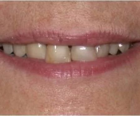 Nainesh A Desai, DDS