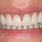 Tempe Family Dentistry