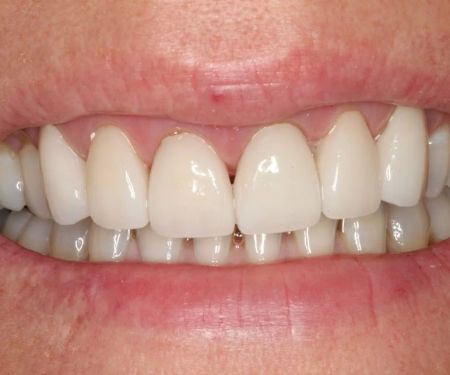 Tempe Family Dentistry