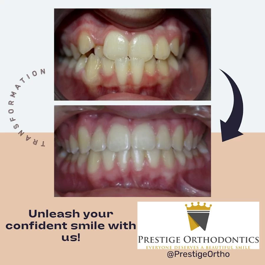 Prestige Orthodontics Picture 8