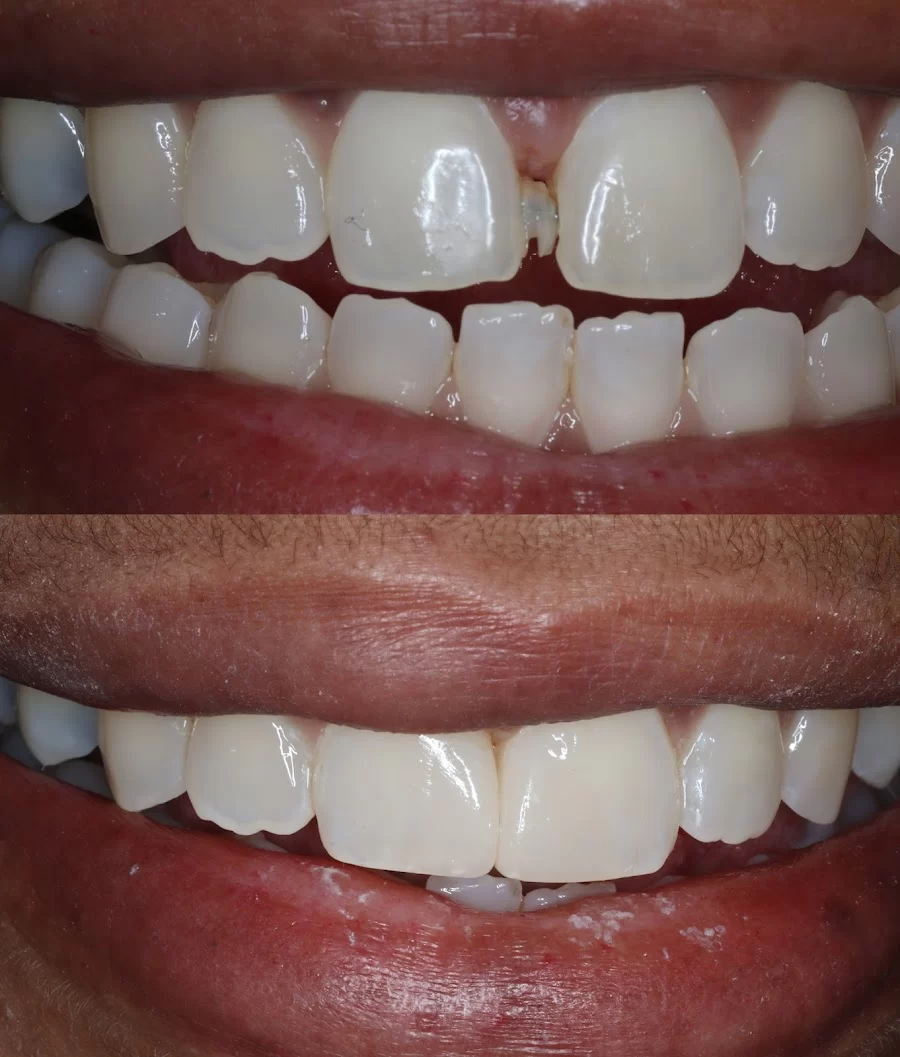 Phillips Ranch Dental Group 7