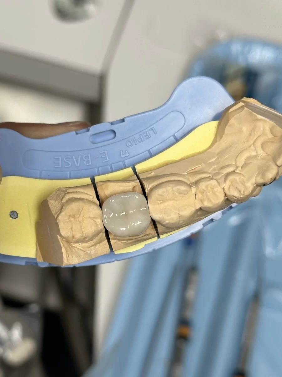 Diamond Bar Dental Studio Picture 6