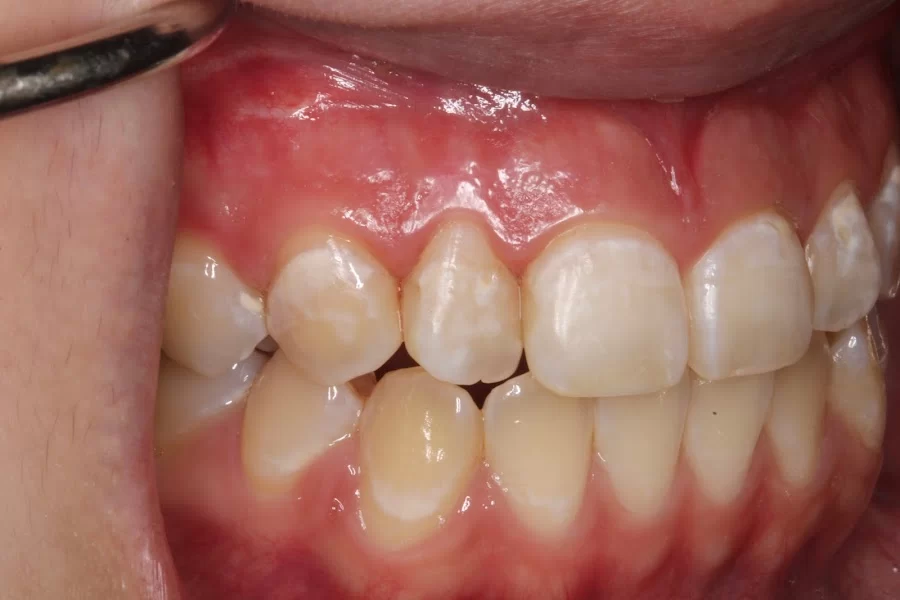 Diamond Bar Dental Studio Picture 3