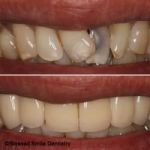 Blessed Smile Dentistry of Diamond Bar