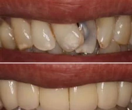 Blessed Smile Dentistry of Diamond Bar
