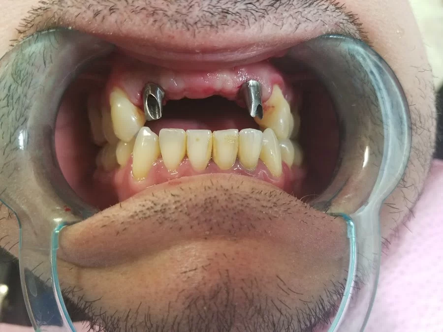Kassab Dental Picture 6