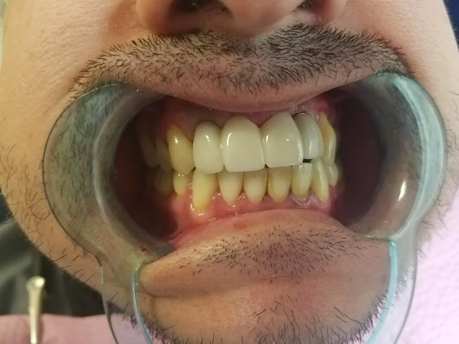 Kassab Dental Picture 4