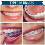 Agoura Dental & Braces