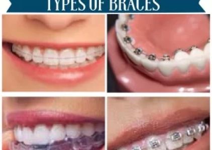 Agoura Dental & Braces