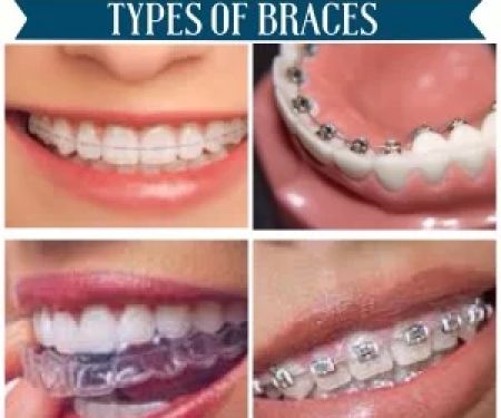 Agoura Dental & Braces