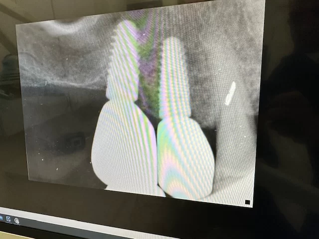 Carson Dental Picture 3