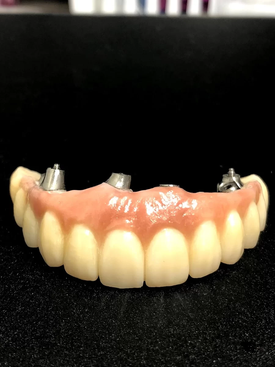 Palani Center For Dental Implants Picture 9