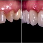 Eco Dental Implant Center
