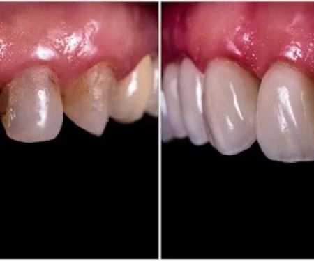 Eco Dental Implant Center