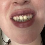 Bright Now! Dental & Orthodontics