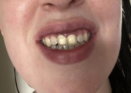 Bright Now! Dental & Orthodontics