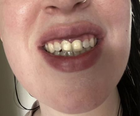 Bright Now! Dental & Orthodontics
