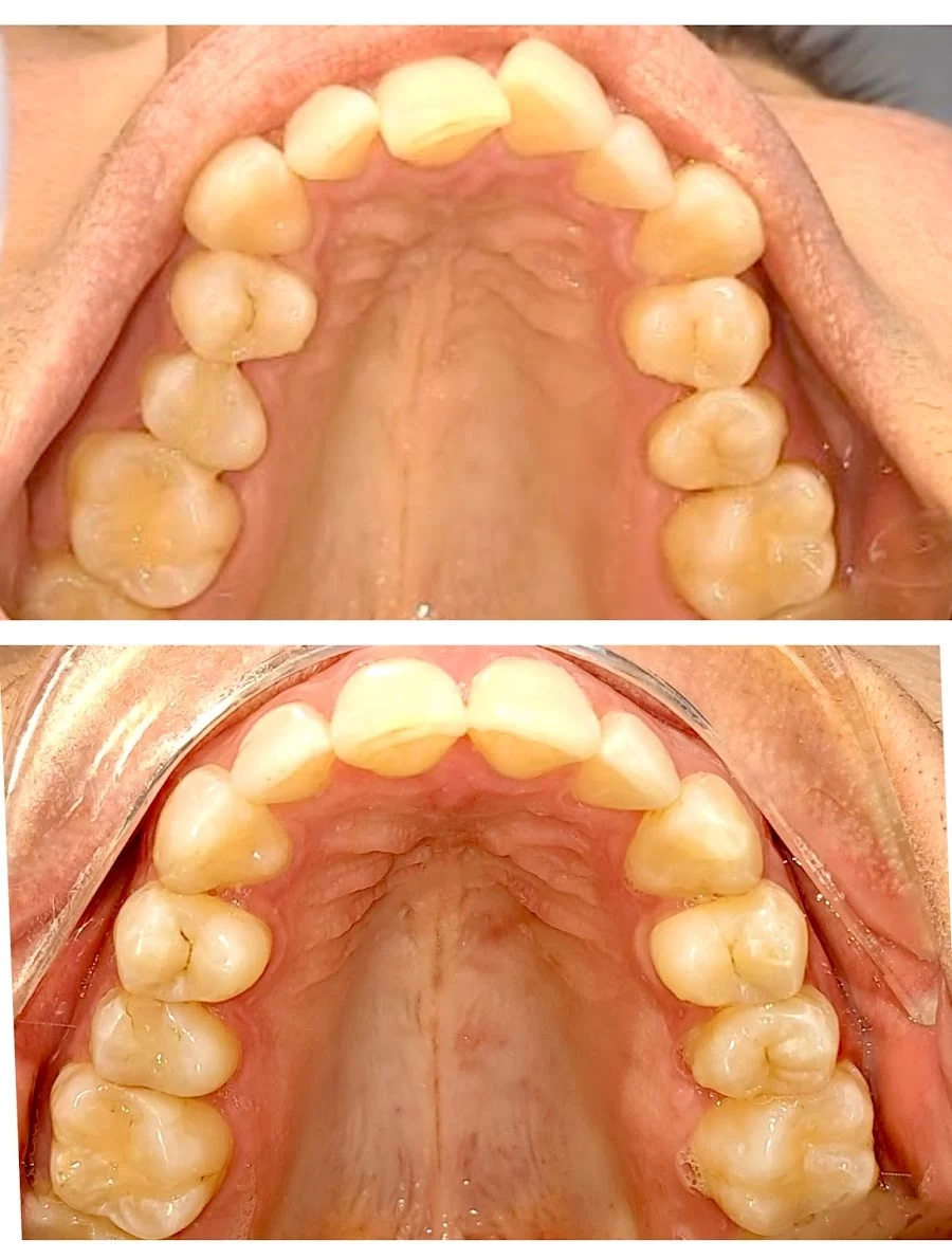 Sunrise Dental Seatac WA Picture 8