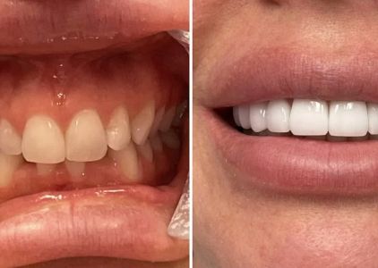 Glisten Dental Studio