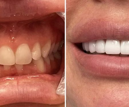 Glisten Dental Studio
