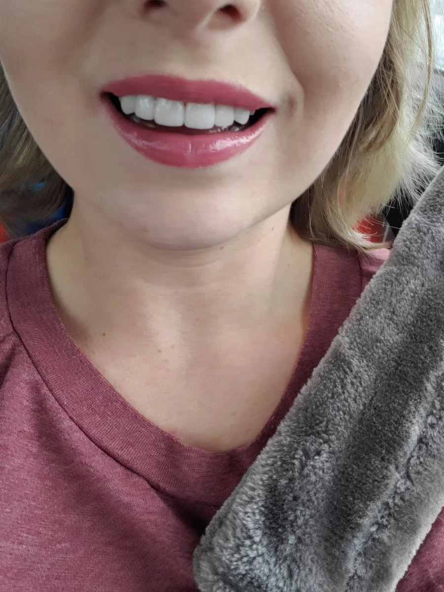 Bellecare Dental Picture 4