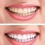 Alpine Dentistry: Brian Buccellato, DDS