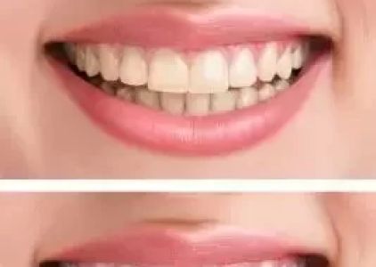 Alpine Dentistry: Brian Buccellato, DDS