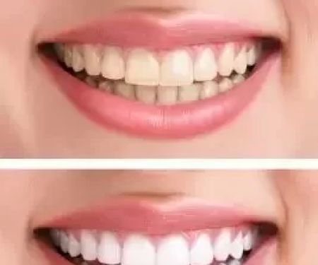 Alpine Dentistry: Brian Buccellato, DDS