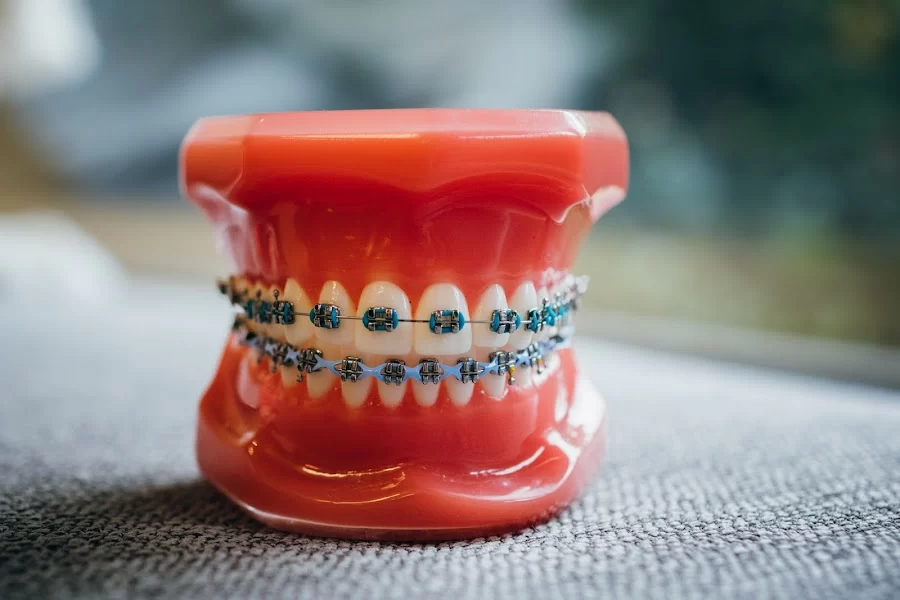 Amrit Burn Orthodontics 2