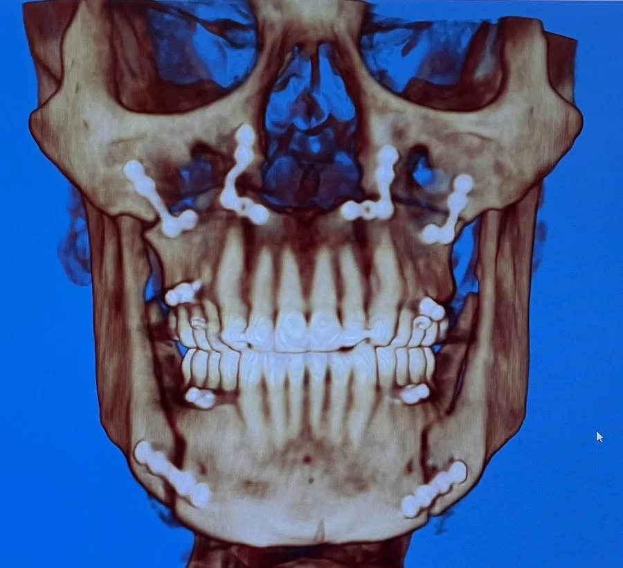 Roosevelt Dental Center Picture 5