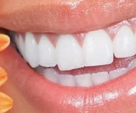 Connie E. Morris DDS-South San Francisco General Dentist