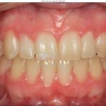 Elevation Dental