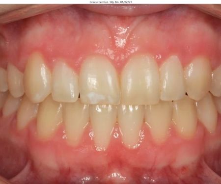Elevation Dental