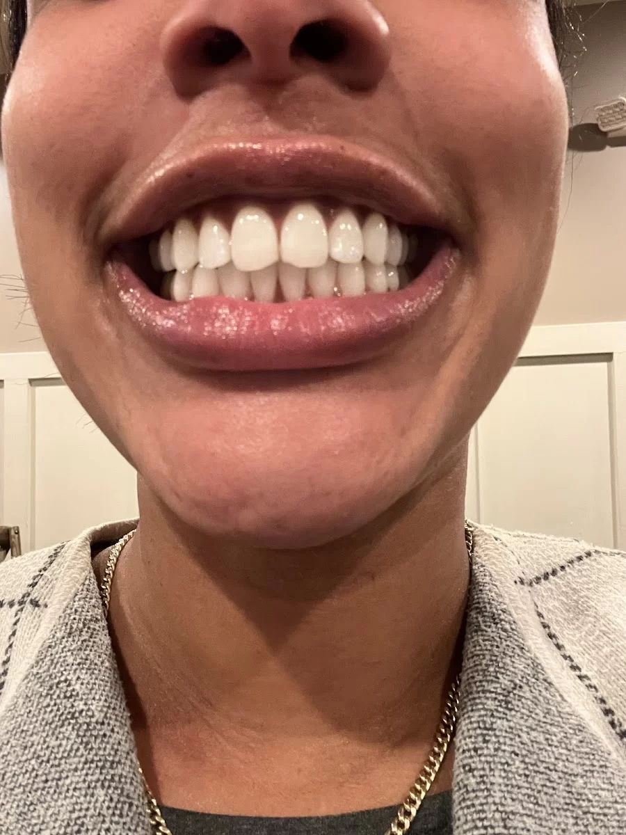Gentle Dental Seekonk Picture 10