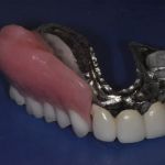 Nashville Cosmetic and Implant Dentistry