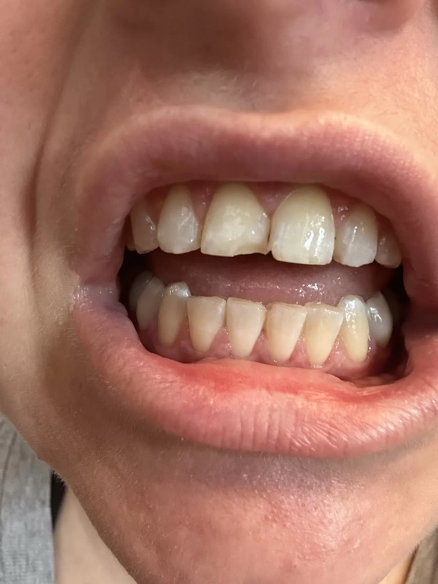 Chiquita Dental Care Picture 7