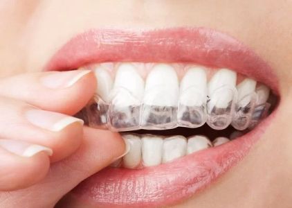 Dentistry Apache Junction Dr. Abedi's Family and Cosmetic
