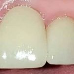 Canyon Vista Dental Care: Dr. John Bigler