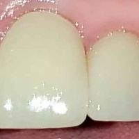 Canyon Vista Dental Care: Dr. John Bigler ico